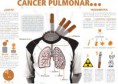 /album/fotogaleria-salud/cancerpulmon-jpg/